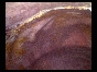 ADHESIONS BOWELS OMENTAL17 ADHESIONS BOWELS OMENTAL17
